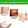 EELHOE Anti Acne Facial Wash, Deep Clean Oil Dirt Blackhead Acne Shrink Pores Refreshing And Comfortable